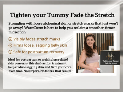 WarmDerm Dual-Action RF & EMS Skin Tightening Device – 2025 New Release | ThermaLift + MicroPulse™ Technology for Face & Neck | Collagen Boosting, Wrinkle Reduction & Facial Toning at Home
